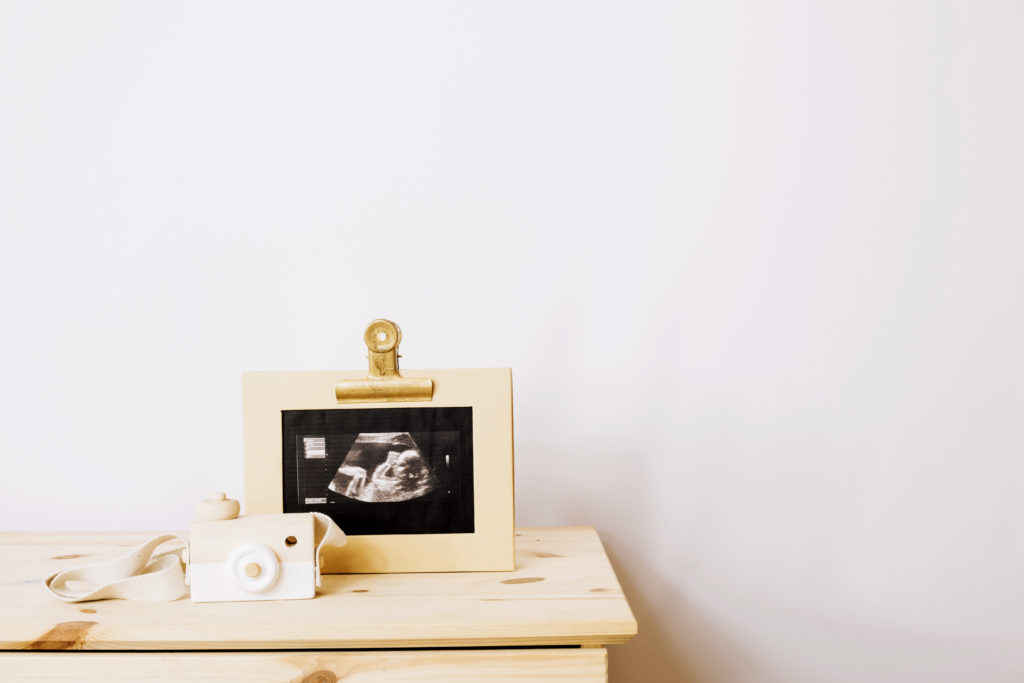 4ª SEMANA DE GESTAÇÃO